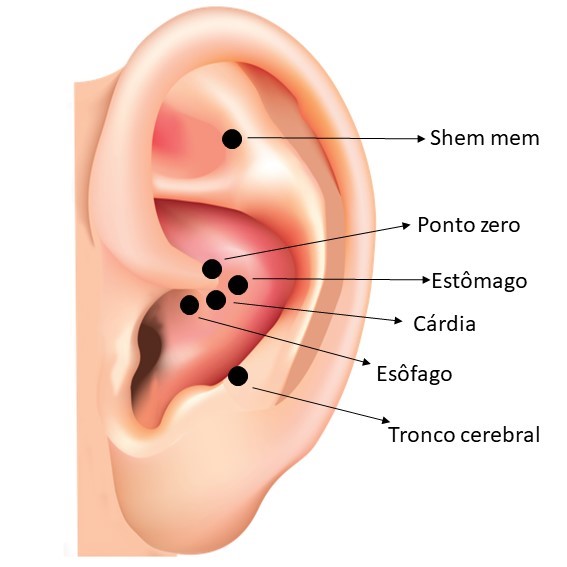 pontos auriculoterapia