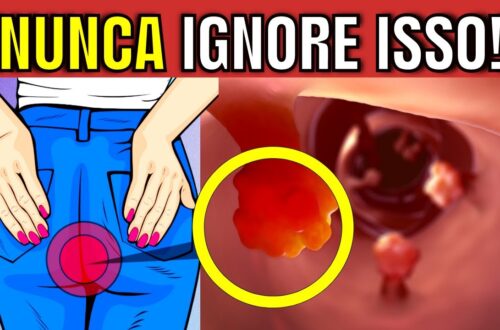 7-SINTOMAS-de-ALERTA-de-CANCER-DE-INTESTINO-que-voce-NUNCA-PODE-IGNORAR