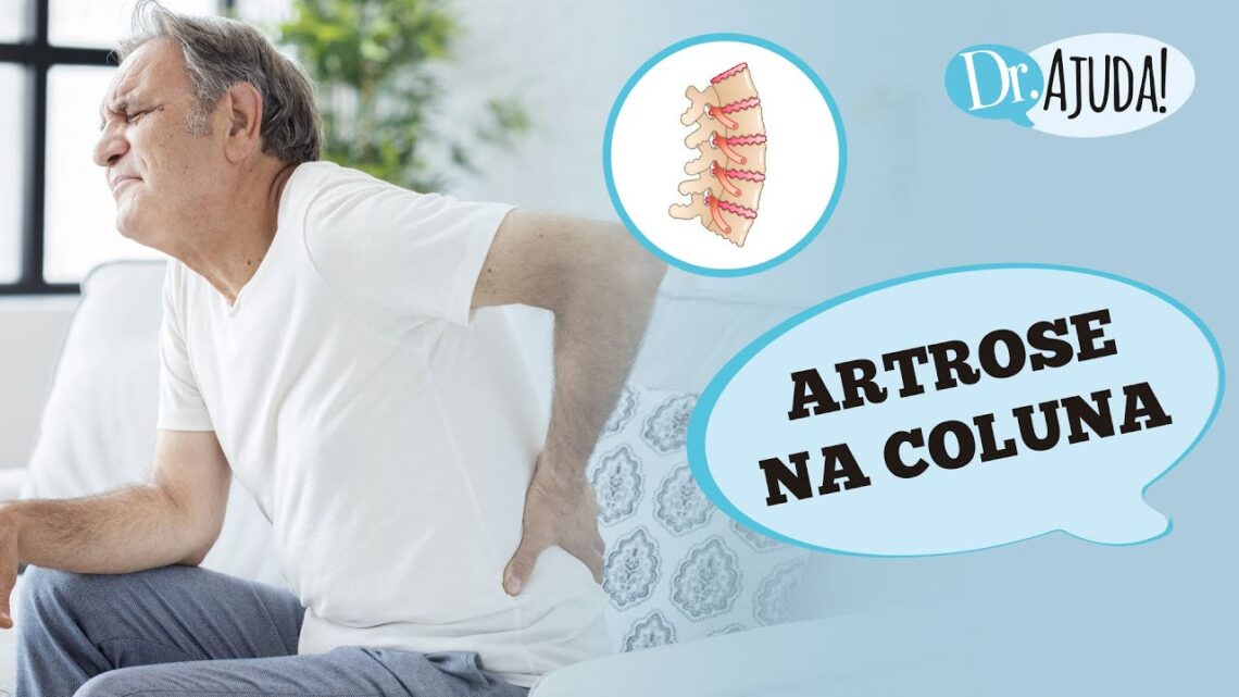 ARTROSE-NA-COLUNA-O-QUE-E-SINTOMAS-DIAGNOSTICO-E-TRATAMENTO