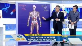 Artrite-e-artrose-saiba-como-prevenir-e-tratar-no-Voce-e-o-Doutor