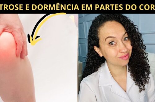 Artrose-O-que-e-quais-os-sintomas-e-como-tratar-Nutri-Vanessa-Gaudiano