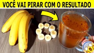 DESINCHA-A-BARRIGA-E-MELHORA-O-SONO-COM-APENAS-1-BANANA