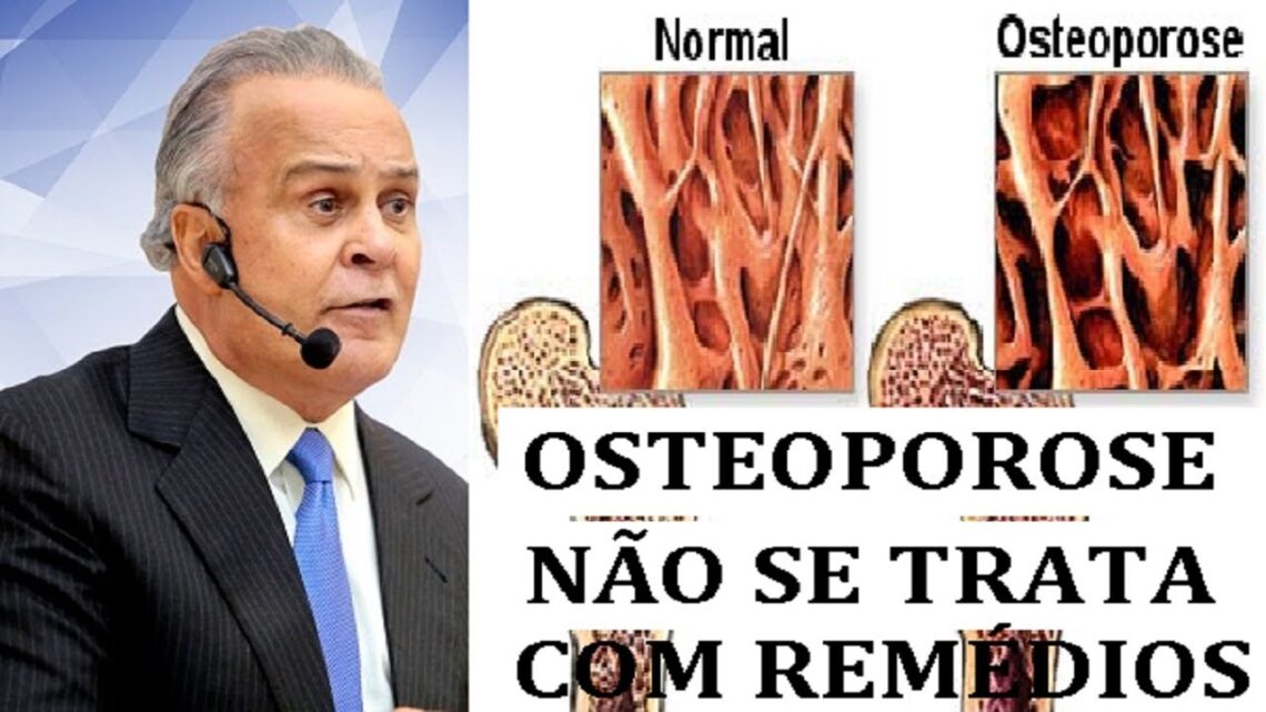 Dr-Lair-Ribeiro-COMO-VENCER-A-OSTEOPOROSE.-OSTEOPOROSE-NAO-SE-TRATA-COM-REMEDIOS-PELO-CONTRARIO