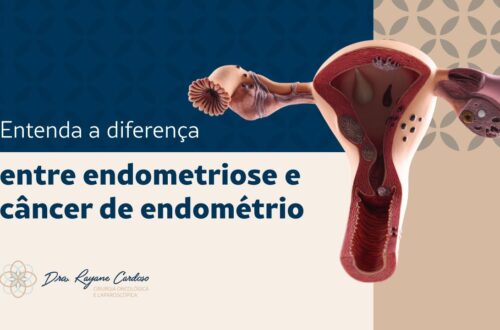 Entenda-a-diferenca-entre-endometriose-e-cancer-de-endometrio