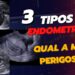 O-3-tipos-de-ENDOMETRIOSE-Qual-o-mais-perigoso