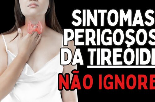 OS-4-SINTOMAS-MAIS-PERIGOSOS-DA-TIROIDEO-Dr-Dayan-Siebra