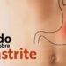 TUDO-SOBRE-GASTRITE-SINAIS-SINTOMAS-E-TRATAMENTO-Dr.-Marcelo-Lima