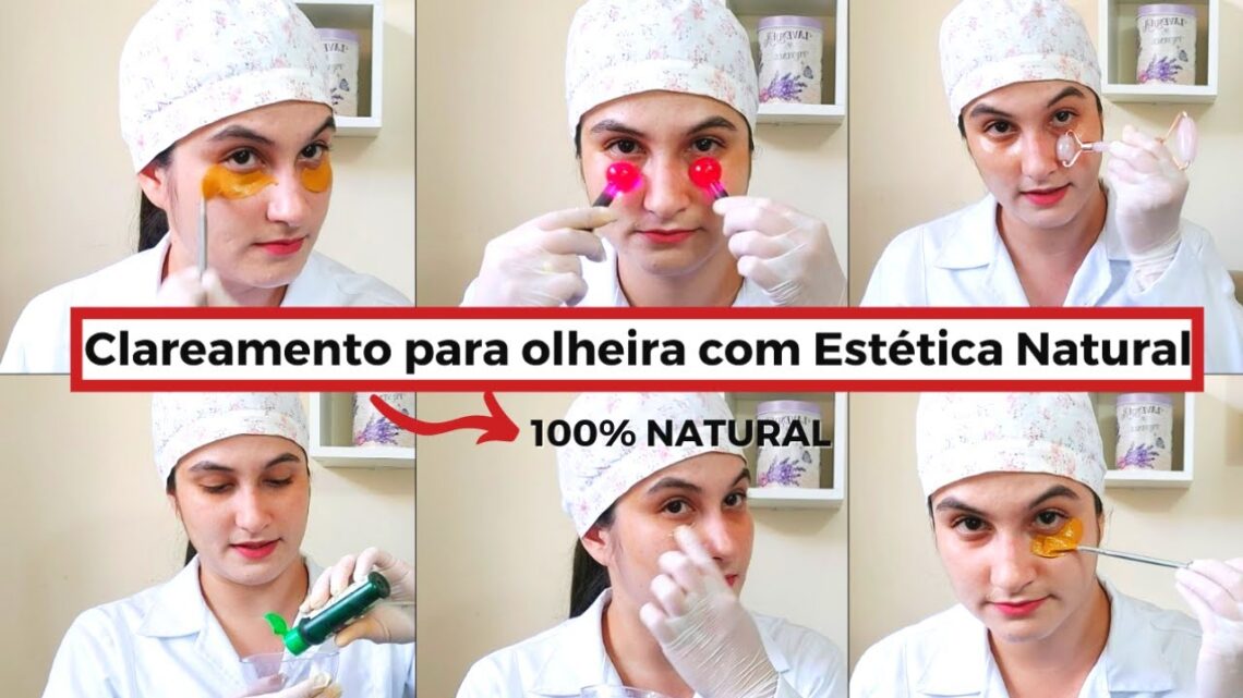 Tratamento-de-olheira-com-estetica-natural-100-natural