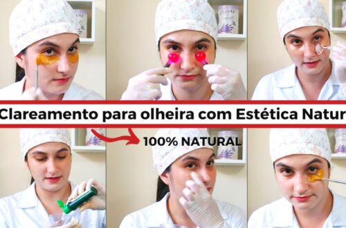 Tratamento-de-olheira-com-estetica-natural-100-natural