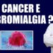 Existe-relacao-entre-o-CANCER-E-A-FIBROMIALGIA