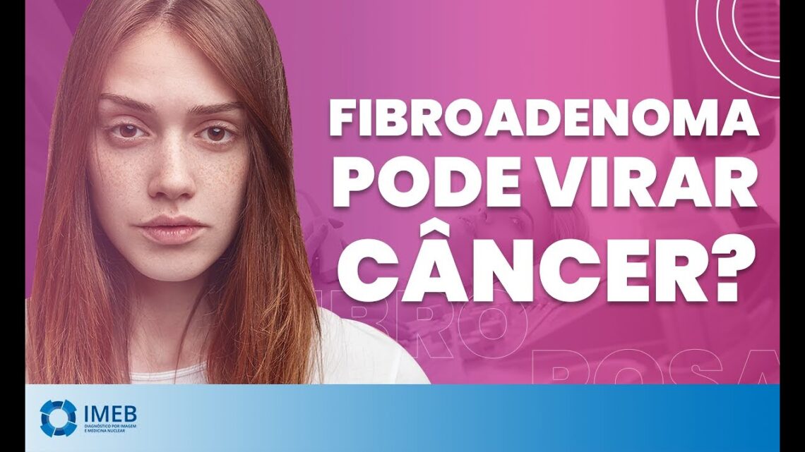 Fibroadenoma-pode-virar-Cancer-IMEB