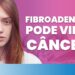 Fibroadenoma-pode-virar-Cancer-IMEB